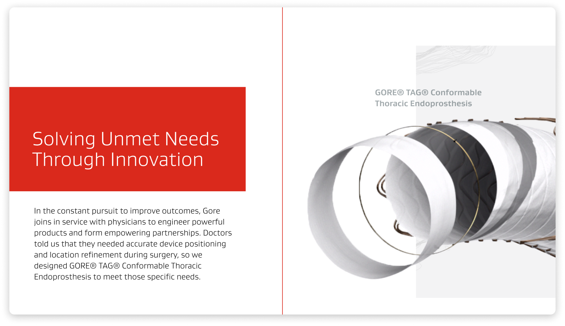 Ento packaging side view A